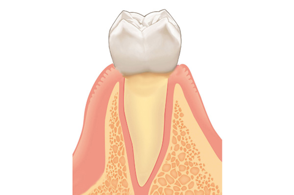 移植する歯（ドナー歯）の根っこが単純な形（歯の根が１本など）であること